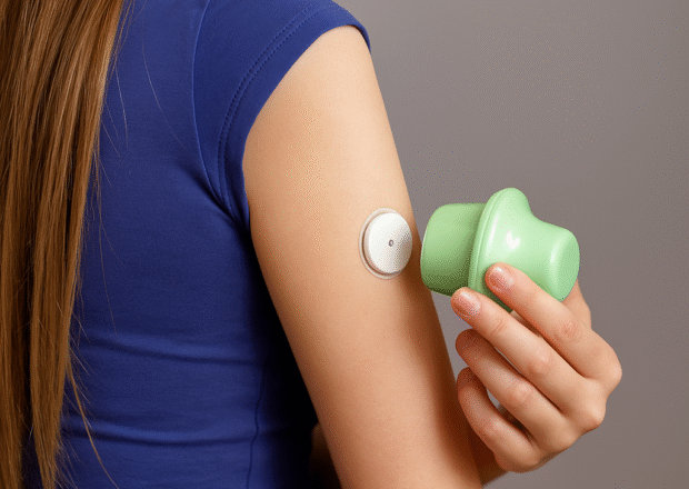 Linx CGM paigaldus